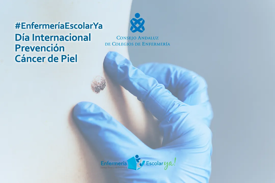 PREVENCIÓN CÁNCER DE PIEL